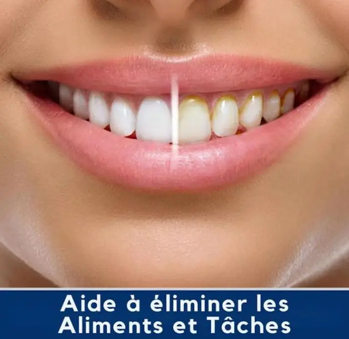 miracle smile 6.webp